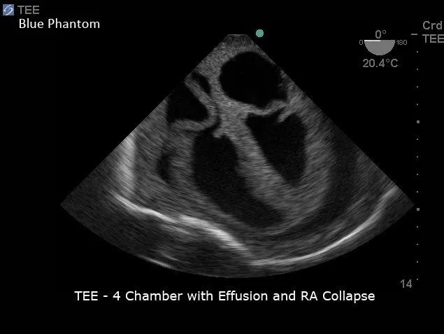 Transesophageal Echo and Transthoracic Echo Training Model