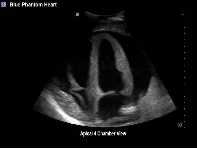 Transesophageal Echo and Transthoracic Echo Training Model