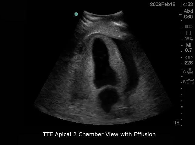 Transesophageal Echo and Transthoracic Echo Training Model