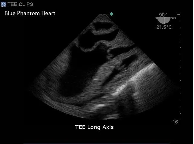 Transesophageal Echo and Transthoracic Echo Training Model